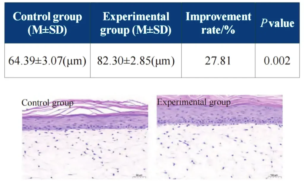 PDRN and Viable Epidermal Thickness in a UVA-Stressed 3D Skin Model